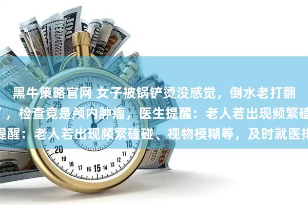 黑牛策略官网 女子被锅铲烫没感觉，倒水老打翻，家人以为“年纪大了”，检查竟是颅内肿瘤，医生提醒：老人若出现频繁磕碰、视物模糊等，及时就医排查